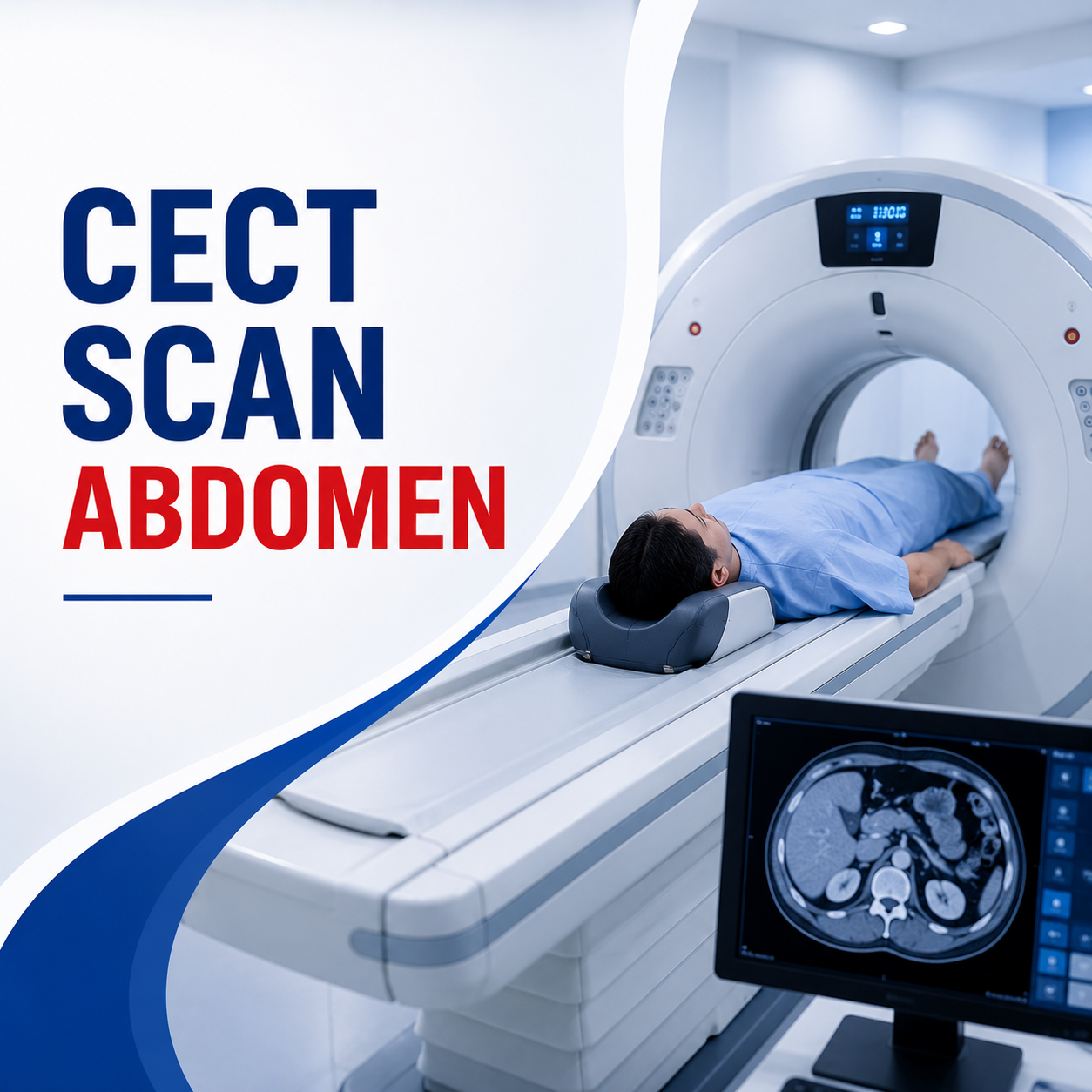 CECT Scan Abdomen