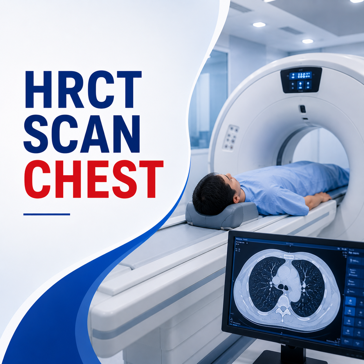HRCT Scan Chest